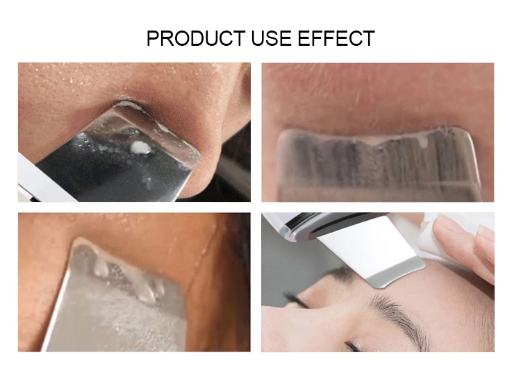 Facial Pore Cleaning အတွက် Ultrasonic Skin Scrubber